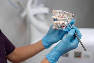 صناعة طقم الأسنان الكامل